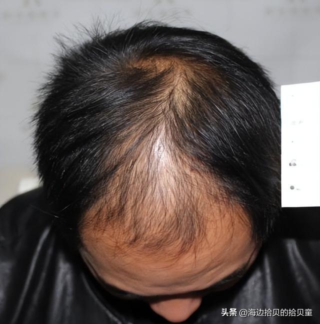 好？育发液什么牌子最有效果？新葡京日本生发液哪个牌子最(图4)